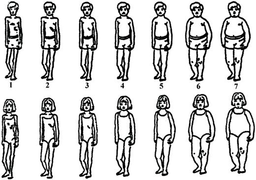 Standardized shapes of children