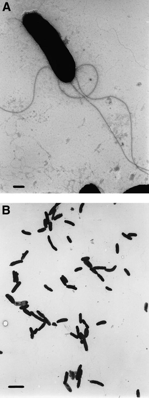 Electron micrographs of culture LET-13; bars indicate 0.2 μm and 2 μm, respectively.