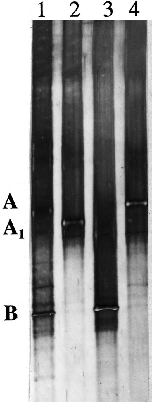 Silver-stained TGGE profile of product originating from V6–V8 region 16S rRNA genes extracted from LET-13: 1, LET-13; 2, clone I; 3, clone II; 4, clone III. The strong bands are indicated as A and B, respectively, and a weak band as A1.