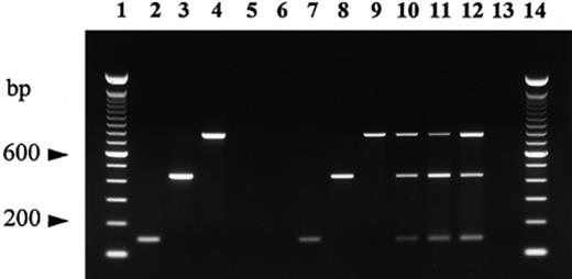 Multiplex PCR amplification of DNA isolated from ascocarps of T. melanosporum, T. brumale and T. indicum, their relative quiescent ectomycorrhizae and host plants using the primers ITS4LNG, ITSB, ITSML, ITSCHCH. Lanes 1 and 14: 100-bp ladder (Gibco BRL); lane 2: T. indicum ascocarp 20; lane 3: T. melanosporum ascocarp; lane 4: T. brumale ascocarp; lane 5: oak root; lane 6: hazel root; lane 7: T. indicum mycorrhiza; lane 8: T. melanosporum mycorrhiza; lane 9: T. brumale mycorrhiza; lanes 10–12: mixtures of T. indicum, T. melanosporum and T. brumale mycorrhizae at a ratio of 1:1:1 with 3 (lane 10), 9 (lane 11) and 30 (lane 12) root tips; lane 13: negative control (no DNA template).