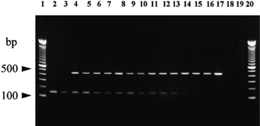 PCR amplification of DNA isolated from mixtures of actively growing ectomycorrhizae of T. melanosporum and T. indicum on potted grown hazel plants using the primers ITS4LNG, ITSB, ITSML and ITSCHCH. Lanes 1 and 20: 100-bp ladder (Gibco BRL); lane 2: T. indicum ascocarp; lane 3: T. indicum ectomycorrhizae; lanes 4–15: mixtures of T. indicum and T. melanosporum ectomycorrhizae at ratios of 1:1 (lanes 4 and 5), 1:3 (lanes 6 and 7), 1:5 (lanes 8 and 9), 1:10 (lanes 10 and 11), 1:25 (lanes 12 and 13), 1:50 (lanes 14 and 15); lane 16: T. melanosporum ectomycorrhizae; lane 17: T. melanosporum ascocarp; lane 18: hazel roots; lane 19: negative control (no DNA template).