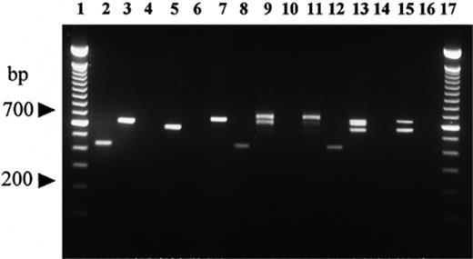 Comparison of products resulting from PCR amplification using species-specific ITS primers vs. universal ITS primers ITS1 and ITS4, on DNA isolated from fruit bodies and mycorrhizal root tips from field-grown plants. Lanes 1 and 17: 100-bp ladder (Gibco BRL); lanes 2, 4, 6, 8, 10, 12 and 14: amplification with ITSB, ITSM, ITSCHCH and ITS4LNG primers; lanes 3, 5, 7, 9, 11, 13, 15 and 16: amplification with ITS1/ITS4 primers. Lanes 2 and 3: T. melanosporum ascocarp; lanes 4 and 5: T. borchii ascocarp; lanes 6 and 7: T. magnatum ascocarp; lanes 8 and 9: non-truffle-forming ectomycorrhizal root tips mixed with a young T. melanosporum mycorrhiza; lanes 10 and 11: non-truffle-forming ectomycorrhizal root tips; lanes 12 and 13: mixture of single young mycorrhizae of T. magnatum, T. borchii and T. melanosporum; lanes 14 and 15: mixture of T. magnatum and T. borchii young mycorrhizae; lane 16: negative control (no DNA template).
