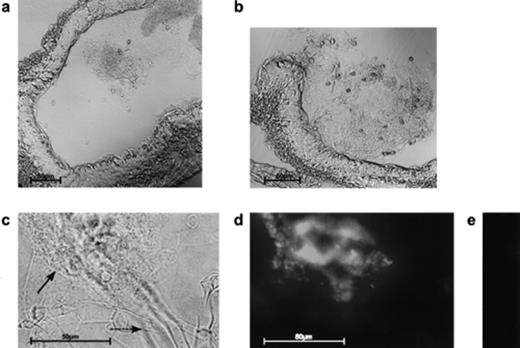 Detection of microorganisms. In cryo-cuts of the mid-gut of E. crypticus, the mixture of fungal and Streptomyces hyphae can be identified under visual light (a, b, c). A higher magnification (c) allowed the identification of the A. proliferans hyphae (—→), which are partly surrounded by a dense network of S. lividans pCHIO12 hyphae (→). Treatment of the hyphae with fluorescein-labelled (d) or unlabelled (control) (e) oligonucleotides characteristic for the 23S rRNA of G+C-rich bacteria (see Section 2) enabled us to additionally identify the Streptomyces hyphae and to inspect them under UV light (d, e).