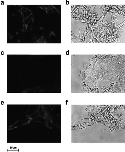 Localization of chitin. As control experiment, intact A. proliferans hyphae were inspected prior to feeding (a, b). Cryo-cuts of the gut of E. crypticus (which had been fed with a mixture of A. proliferans and S. lividans pCHIO12 (c, d) or with A. proliferans and S. lividans pIJ702 (control) (e, f)) were treated with rhodamine-labelled CHB1, as described in Section 2. Samples were inspected by confocal laser microscopy under visual light (b, d, f) (right) or under UV light (a, c, e) (left).