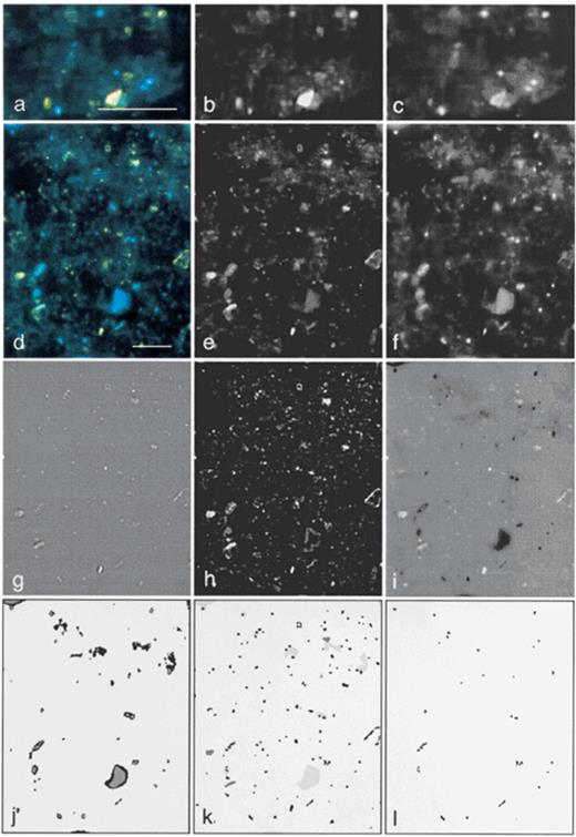 Different stages during image processing of a foregut sample of L. terrestris. High magnification views of the RGB image (a), the green channel of the RGB image (b), and the blue channel of the RGB image (c). Low magnification views (320×400 pixels) of an RGB image (d), the green channel of the RGB image (e), the blue channel of the RGB image (f), the green channel after Marr–Hildreth procedure (g); the green channel after background subtraction (h); subtraction of preprocessed images from blue and green channel (i) and the detection of DAPI-halos after binarizations (j); the combined binary image (k) showing: (1) all objects (black objects, binarization of g); (2) debris (dark gray objects, binarization of h); and (3) DAPI-halos (light gray objects); and the detection of bacteria after deletion of all non-bacterial objects (l). Scale bar: 10 μm.