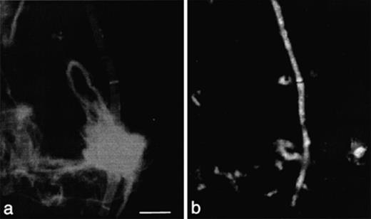 Detection of filamentous fungi in leaf material after staining with Calcofluor M2R (a) and after in situ hybridization with Cy3-labeled oligonucleotide probe EUK516 (b). Scale bar: 10 μm.