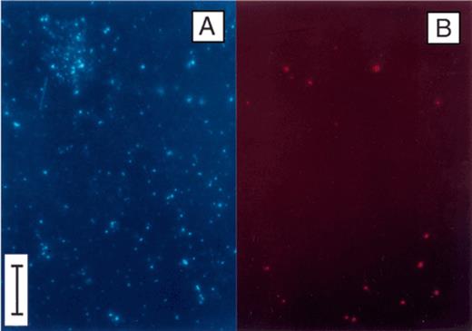 Epifluorescence photomicrographs of bacterial cells collected at 0.3 m depth in Zwischenahner Meer on 15 May 1996. The sample was incubated with CTC, and subsequently counterstained with DAPI. A. DAPI fluorescence (filter set No. 01). B. Same microscopic field showing red fluorescence of CTC-reducing cells (filter set No. 15). Bar, 10 μm.