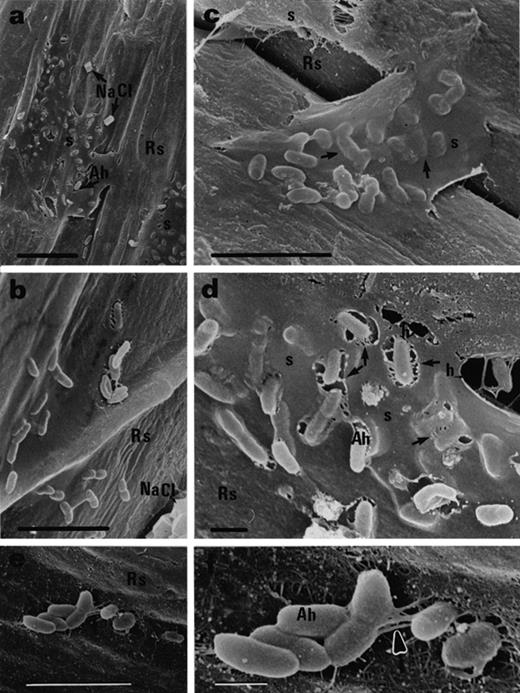 Black mangrove root colonization by A. halopraeferens AU10, 3 days after inoculation. a, b: Single cells embedded in a thick mucilaginous sheath. Note NaCl crystals on the root surface. c: Single cells reside under the sheath (arrows). d: Halos in the sheath (thin arrows) surrounding the bacteria which are connected to the surface by fibrils (thicker arrows). e: Small bacterial aggregates on the root surface. f: Magnification of (e) showing fibrils (arrow) connecting the aggregate to the root surface. Abbreviation: Ah, A. halopraeferens AU10; Rs, root surface; s, sheath; h, halo. Bars represent 10 μm (a), 5 μm (b, c, e) and 1 μm (d, f).