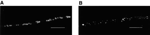 Nucleic acids of P. ultimum stained with Syto 13. (A) Untreated fungus. Nuclei were randomly distributed in the coenocytic hyphae. (B) Hyphae treated with viscosinamide. The randomly distributed nuclei were smaller than in the control and extranuclear staining was apparent. A blue 450–490 filter was used for fluorescence microscopy. Bar=15 μm.