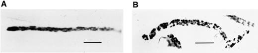 Mitochondria of P. ultimum stained with DIOC7(3). Negative image. (A) Untreated fungus. Filamentous mitochondria were present in the hyphae. In the tips, the densities of metabolically active mitochondria were high. (B) Treated with viscosinamide. The mitochondria in these hyphae, arrested in growth, appear as short rods compared to mitochondria in the non-disturbed hyphae. A blue 450–490 filter was used for fluorescence microscopy. Bar=15 μm.
