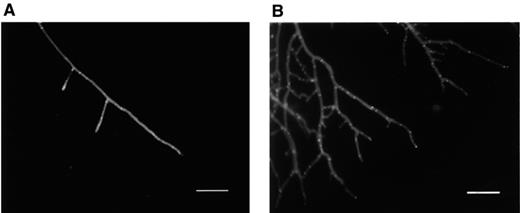 Mycelium of R. solani grown in a soil microcosm stained with Calcofluor white. (A) Untreated fungus. Straight long hyphal tip with few branches and septa. (B) Treated with viscosinamide. The hyphae were branched and highly septated. An UVG365 filter was used for fluorescence microscopy. Bar=80 μm.