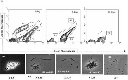 Growth of P. aeruginosa 19SJ on solid phenanthrene in the absence of clay–humic acid complexes. The number of days of incubation is given in the upper right-hand corner of the histograms. The defined gates (R1–R8) in the histogram were subject to phase contrast microscopy after sorting (below): R1 and R5 are single bacteria; R2 and R6, small bacterial aggregates and medium-sized filaments; R4, phenanthrene crystals; R3 and R7, aggregates of phenanthrene crystals and bacteria; R8, single small bacteria. Magnification is 2500× the factor shown below each picture.