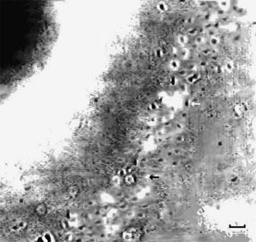Digital image of bacterial band around a bead (scale bar equivalent to 5 μm). The bacteria in focus are seen as black dots (example indicated by white arrow), while the bacteria going in or out of the plane of focus are seen as white dots (example indicated by black arrow). This is a single tick band, refer to Table 1.