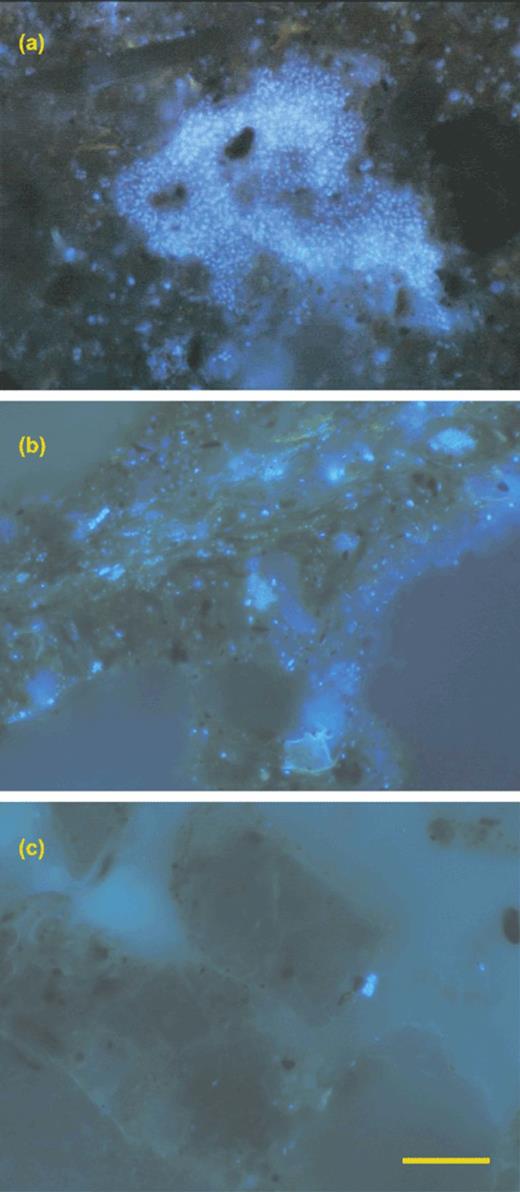 Examples of bacterial colonisation of soil; after the addition of glucose (a), in topsoil sampled after harvest (b) and in subsoil (c). Scale bar represents 20 μm. Colonised microsites were generally separated by relatively uncolonised regions, in particular in the subsoil. The image of topsoil (panel b) depicts a relatively densely populated region.