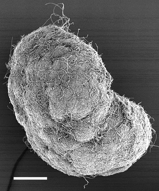 Scanning electron micrograph of a whole granule. Bar=100 μm.