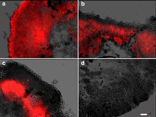 A superimposition of differential–interference contrast images and epifluorescence images taken of Nile blue A stained granule sections. Samples were taken at (a) the beginning of the aerobic period, (b) 30 min and (c) 75 min into the aerobic period and (d) at the end of the aerobic period. Bar=10 μm.