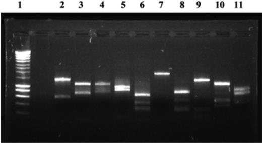RFLP analysis of dsrAB sequences retrieved from sediment samples. The dsrAB sequences present in the Seine estuary sediments were amplified and cloned. RFLP analysis based on the EcoRI/SacI restriction patterns was performed, and classified the dsrAB sequences into 10 clone families. The gel electrophoresis corresponds to EcoRI/SacI restriction patterns of one clone of each group: lanes 2–11, clone families CF1–10; lane 1, size ladder (Eurogentec).