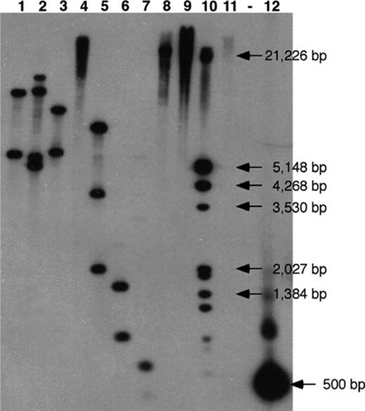 Southern hybridization of S65 genomic DNA using the pyrene catabolic gene probe, nidA, derived from S65. Genomic DNA of strain S65 was digested with various restriction enzymes and was tested for the presence of the nidA gene identified in Mycobacterium sp. strain PYR-1. S65 genomic DNA was digested with lane1, BamHI; lane 2, EcoRI; lane 3, EcoRV; lane 4, HindIII; lane 5, SacI; lane 6, SacII; lane 7, SalI; lane 8, SpeI; lane 9, XbaI; lane 10, DIG marker; lane 11, S65 plasmid; (-) blank lane; lane 12, nidA PCR probe.