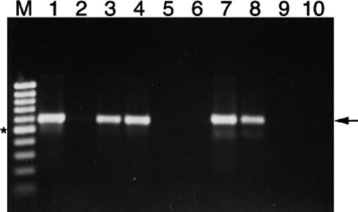 PCR amplification at an annealing temperature of 65 °C of plasmid DNA from the nid and pdo clones derived from Mycobacterium sp. S65 using primers designed specifically from the nidA gene. Lane M is a 100 bp molecular weight ladder, lanes 1–5 are the nid clone (1), the pdo clone (2), S65 (3), PYR-1 (4) and negative control (5), all amplified using the nidAF/nidAR primers, and lanes 6–10 are the nid clone (6), the pdo clone (7), S65 (8), PYR-1 (9) and negative control (10), amplified with the pdoAF/pdoAR primers. The star indicates the position of the 500 bp fragment in the molecular marker, and the arrow indicates the position of the expected amplicon.