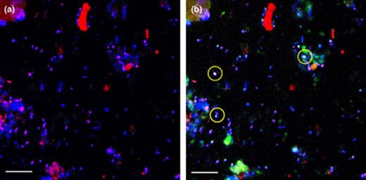 Confocal laser scanning microscope (CLSM) images showing DTAF staining and in situ hybridisation of bacteria in a soil sample from the top 5 cm. Both pictures show identical microscopic fields, displayed in different artificial colours. (a) Hybridisation with probe EUBmix-Cy5 (red), additional all cells were stained with DTAF (blue). Due to double staining the target Bacteria cells appear purple. (b) Additional hybridisation with probe CFmix-Cy3 (green). Target Cytophaga–Flavobacterium cells appear yellow, due to threefold staining. Some of them were marked with yellow circles. The scale bars represent 10 μm.