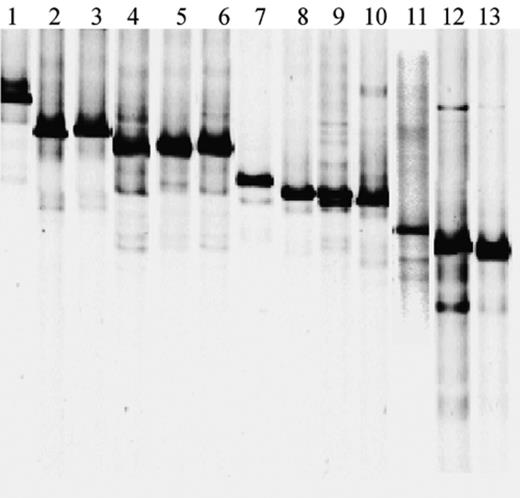 PCR–DGGE profiles of Acinetobacter 16S rRNA gene amplicons obtained from pure strains using the Acinetobacter specific primers GC-Ac436f and Ac676r. Lanes: 1, A. johnsonii DSM6963T; 2, A. calcoaceticus DSM30006T; 3, Acinetobacter sp. ATCC10153; 4, A. haemolyticus LH168; 5, Acinetobacter sp. ATCC27197; 6, A. haemolyticus DSM6962T; 7, A. venetianus RAG-1; 8, A. radioresistens DSM6976T; 9, A. lwoffii DSM2403T; 10, Acinetobacter sp. DSM586; 11, A. baumannii DVL5014, 12, A. junii DSM6964T; 13, Acinetobacter sp. DSM11652.