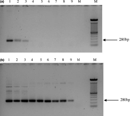 Amplification of 16S rRNA gene of Acinetobacter sp. RAG-1 introduced in soil samples using direct PCR with primers GC-Ac436f and Ac676r (a), and using the nested PCR approach (b). Legend: 108 CFU/g soil (1), 107 CFU/g soil (2), 106 CFU/g soil (3), 105 CFU/g soil (4), 104 CFU/g soil (5), 103 CFU/g soil (6), 102 CFU/g soil (7), 101 CFU/g soil (8), 1 CFU/g soil (9), blank (bl), and 100 bp marker (M).