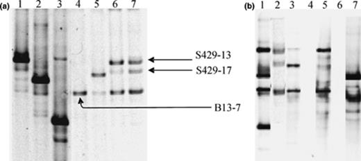 16S rRNA gene DGGE fingerprinting of Acinetobacter communities in hydrocarbon contaminated soil samples using PCR products obtained with Acinetobacter specific primers GC-Ac436f and Ac676r in the direct PCR approach (a) and the nested PCR approach (b). (a) DGGE profiles for strain A. johnsonii DSM6963T (lane 1), strain Acinetobacter sp. LH168 (lane 2), strain A. junii DSM6964T (lane 3), soil B13 (lane 4), soil B15 (lane 5), soil S428 (lane 6), soil S429 (lane 7). Cloned ‘bands’ are indicated within the soil fingerprint based on the comparison of the migration profiles of pure clones and the soil profile. (b) DGGE ladder (lane 1); DGGE profile of soil S429 obtained by the direct PCR (lane 2), and the nested PCR (lane 3); DGGE profile of soil S431 obtained by the direct PCR (lane 4), and the nested PCR (lane 5); DGGE profile of soil B4 obtained by the direct PCR (lane 6), and the nested PCR (lane 7); The DGGE ladder consists of A. johnsonii, A. haemolyticus, A. lwoffii, and A. junii.