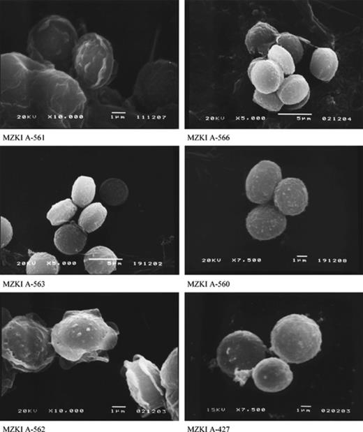 Scanning electron micrographs of E. amstelodami (MZKI A-561), E. repens (MZKI A-566), E. rubrum (MZKI A-563), “E. halotolerans” (MZKI A-560), E. chevalieri (MZKI A-562) and E. herbariorum (MZKI A-427) ascospores.