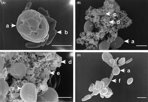 Observation of symbiotic conformation by SEM. Mixed culture of C. sorokiniana with CSSB-1 (panel A), with CSSB-2 (panel B), with CSSB-3 (panel C), with CSSF-1 (panel D). Symbols: C. sorokiniana (a), CSSB-1 (b), CSSB-2 (c), sheath (d), CSSB-3 (e) and CSSF-1 (f). The size of the white bar is 2 μm.