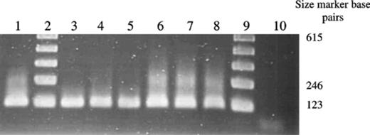 Detection of P. lilacinus in soil using P. lilacinus specific primers. Lane order: Lanes 2 and 9,123 bp marker; Lane 1, Positive control RES Pl1; Lanes 3–5, DNA extracted from soil taken at Ely; Lanes 6–8, DNA extracted from soil taken at Spalding; Lane 10, DNA extracted from control soil.