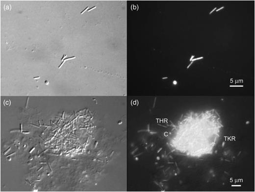 Destructive interference contrast (DIC) (a) and fluorescence (b) images of an acridine orange (AO)-stained preparation from a 4th generation transfer of the H2/CO2 enrichment culture from McLean bog, showing thin rods plus a coccoid cell. DIC (c) and fluorescence (d) images of a large aggregate containing thin rod (THR)-shaped and coccoid (c) cells as well as thick rod-shaped cells (TKR) outside the aggregate.