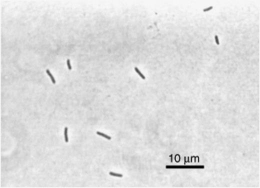 Phase contrast micrograph of the citrate-utilizing thick rod TR1 isolated from culture 6A.
