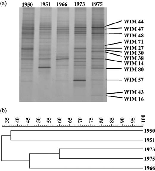 (a) Small subunit rRNA gene-targetted PCR–denaturing gradient gel electrophoresis profile of the eukaryotic community in air-dried soil samples from various years originating from Wieringermeer polder. 1950, 1951, 1966, 1973, 1975 indicate the year of sampling. The numbered bands on the 1975 profile indicate matching clones from the corresponding rRNA library. (b) UPGMA cluster analysis of the similarity indexes calculated for the various denaturing gradient gel electrophoresis profiles.