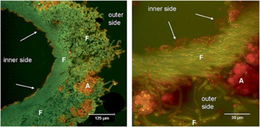 Acridine orange-stained transversal sections of Cladonia arbuscula showing bacterial colonization on the internal surface and also to a lower extent on the outside (CLSM image). Left panel, overview; right panel, detail. A, algal cells; F, fungal hyphae; arrows, bacteria.
