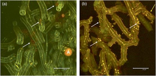Acridine orange-stained sections of Cladonia arbuscula showing bacteria on hyphae of the external lichen surface (CLSM image). Thin yellow central lines in hyphae represent the cytoplasm of the fungus. (a) Clusters of bacterial colonies. (b) Colonization by different bacterial morphotypes. A, algal cells; white arrows, bacteria adhering to the hyphae; yellow arrow, bacteria inside hyphae.