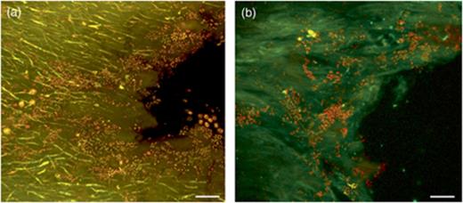 Detection of bacteria by acridine orange and FISH in Cladonia arbuscula (diagonal sections of inner surface, CLSM images). (a) Acridine orange: bacterial cells are yellow-orange particles. (b) EUB338MIX-Cy3 and HGC236-Cy5 bacterial FISH probes: Actinobacteria are yellow objects, and other bacterial cells are red. Scale bars are 15 μm.