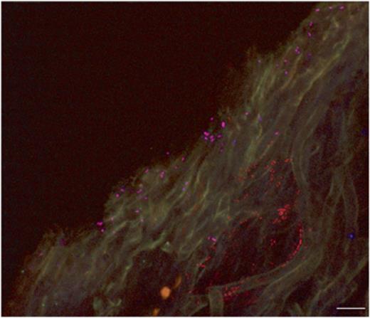 Stratified bacterial colonies in the inner surface of Cladonia arbuscula as detected by simultaneous use of EUB338MIX-Cy3 and ALF968-Cy5 FISH probes (CLSM image of transversal section). Pink, Alphaproteobacteria (stained by the universal bacterial probe EUB338MIX-Cy3 and the specific probe ALF968-Cy5); red, other bacteria (stained by EUB338MIX-Cy3 only). Scale bar is 10 μm.