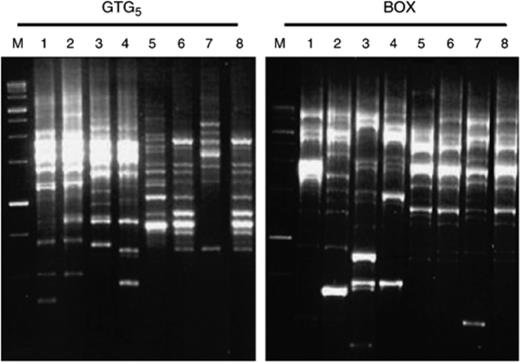 Representative Rep-PCR profiles of red-pigmented Vibrio isolates. Lane M, 1-kb ladder; lane 1, isolates MSSRF28 (REP group A1); lane 2, MSSRF10 (REP group A3); lane 3, MSSRF38 (REP group A5); lane 4, MSSRF39 (REP group A6); lane 5, MSSRF7 (REP group A4); lane 6, MSSRF6 (REP group A2); lane 7, Vibrio ruber JCM 11486T (REP group A7); lane 8, Vibrio rhizosphaerae LMG 23790T (REP group A2).