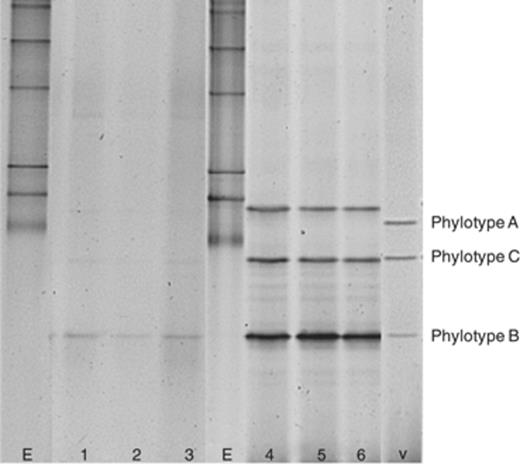 PCR-DGGE detection of Variovorax in agricultural soil using a single and a double PCR approach. Lanes marked by ‘E’ show the bacterial 16S rRNA gene DGGE marker; lanes marked by ‘v’ show the Variovorax 16S rRNA gene DGGE marker. Three replicate DNA extracts from the same soil were amplified with the primer set VarF-GC/VarR. Lanes 1, 2 and 3 show the profiles obtained using a single PCR, while lanes 4, 5 and 6 show the DGGE profiles of PCR products obtained from a double PCR performed on amplicons obtained from the first PCR.