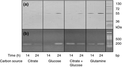 Expression of alkaline proteinase by Pseudomonas fluorescens strain ON2-gfp2 during growth in minimal medium supplemented with different carbon sources. (a) Western blot assay to demonstrate AprX proteinase in culture supernatants from growth on different carbon sources. (b) RT-PCR detection of the aprX transcript in the cells of P. fluorescens ON2-gfp2 from growth on different carbon sources.