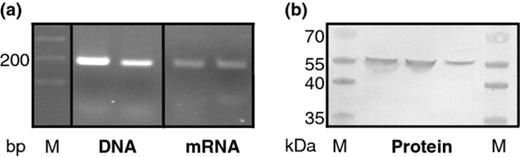 Expression of alkaline proteinase by Pseudomonas fluorescens strain ON2-gfp2 during growth in lake water. (a) Detection of aprX DNA and mRNA in cells from the lake water model system after 24 h. (b) Western blot assay on concentrated samples from lake water microcosms to demonstrate the presence of AprX in this system.