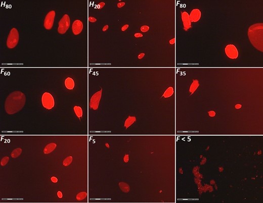 Fluorescence microscopy images of the different protozoal fractions using propidium iodide dye and rhodamine filters. Protozoa fractions were obtained from holotrich-monofaunated (H60 and H20) and totally faunated sheep (F80, F60, F45, F35, F20, F5 and F < 5) using different nylon meshes (80, 60, 45, 35, 20 and 5 μm pore size).