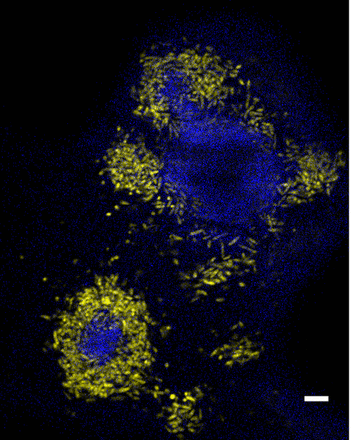 This paper describes the genetic study of a microbial biofilm dedicated to the degradation of a large panel of marine hydrophobic organic compounds in order to identify the biological processes involved in the recycling of the insoluble oily carbon in oceans.