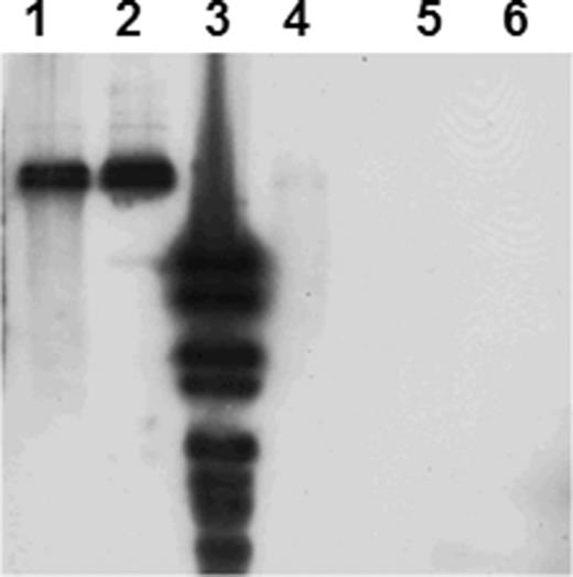Southern blot hybridization of SmaI-digested plasmid DNA with hylA probe. Lane 1, P. putida KT2442 (hylA positive transconjugant of the biparental mating); lane 2, C. necator (hylA positive transconjugant of the triparental mating); lane 3, DIG VI ladder, Fermentas; lane 4, Variovorax sp. strain WDL1 (positive control); lane 5, P. putida KT2442 (recipient of the biparental mating) and lane 6, C. necator (recipient of the triparental mating).