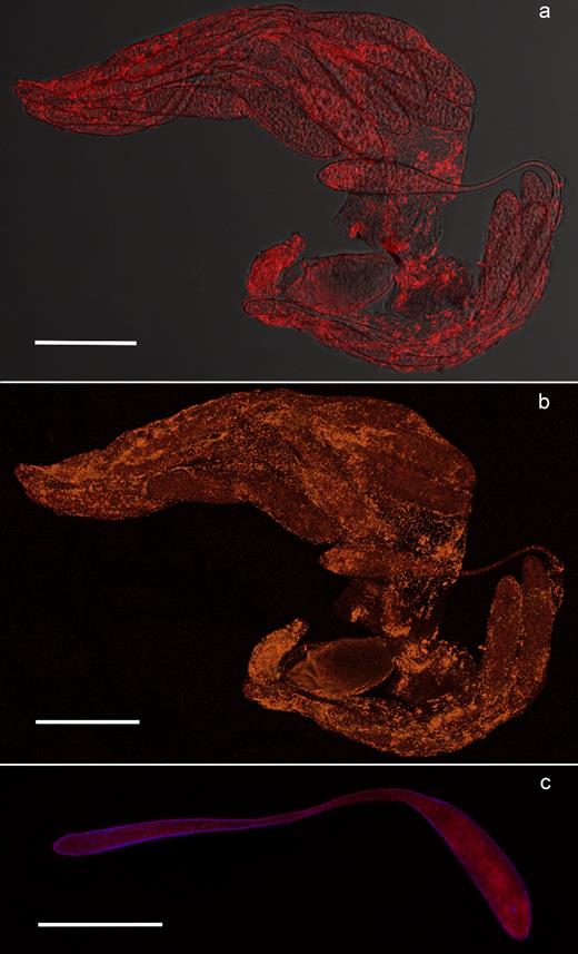 FISH on Q. mendeli ovarioles and eggs. Distribution of Rickettsia in the ovary (a and b) and the egg (c) of Q. mendeli. In the ovary, Rickettsia bacteria (bright red spots) are inside the developing oocytes (a). Merged image of ovarioles simultaneously stained with the Rickettsia-specific probe RickPn-Cy3 and the universal bacterial probe EUB338-Cy5, showing Rickettsia cells in orange (b). Within the egg, bacteria are distributed in the head and in the peduncle (c). DAPI-stained nuclei are blue. Scale bar = 100 μm.