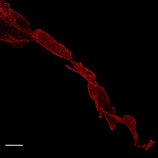 FISH on Q. mendeli gut. Rickettsia bacteria, stained with the Rickettsia-specific probe RickPn-Cy3 (bright red spots), are concentrated along the gut tube and Malpighian tubules. Scale bar = 100 μm.