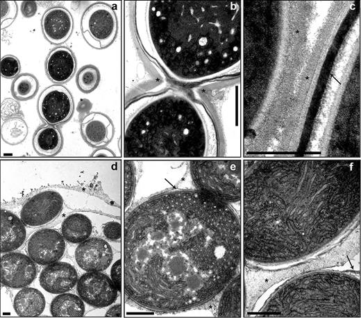 Ultrastructure of akinetes and their envelopes. Akinetes of A. variabilis in cultures exposed to low light (a–c) and of N. punctiforme induced by phosphate starvation for 60 days (d–f). Transmission electron micrographs of akinetes (a and d), connected akinetes (b and e) and akinete envelopes (c–f). Asterisk, exopolysaccharide layer; arrow, glycolipid layer. Bars, 1 μm (a, b, d, e and f) and 500 nm (c).