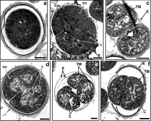 Morphological changes during akinete germination in A. variabilis. Transmission electron micrographs of akinetes at 3 (a), 6 (b and c) and 48 h (d–f) after germination, induced by light. c, initial carboxysomes; C, carboxysome; Cp, cyanophycin; E, akinete envelope; H, heterocyst; tm, undeveloped thylakoid membranes; TM, thylakoid membranes; arrowheads, glycogen. Bars, 1 μm.