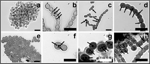 Occurrence of Ppi bodies during germination. Akinetes in A. variabilis (a–d) and N. punctiforme (e–h) cultures starved for phosphate for 16 months were washed and transferred to fresh media with phosphate. Samples were taken and stained with Neisser stain at 0 (a and e), 6 (b and f), 30 (c and g) and 72 h of germination (d and h). Ppi bodies (arrows) stained darkly. Bars, 10 μm.