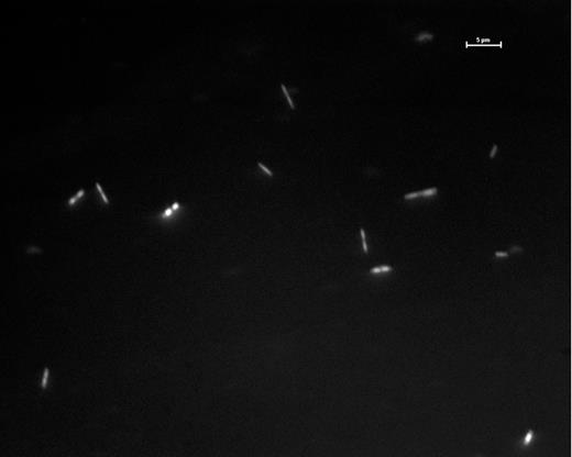 Epiflorescence image of cells from White River Fen peat enriched anaerobically in a peat/water slurry with homopipes buffer (pH 5.4) viewed at 1000x, and stained with acridine orange (white bar = 5 μm).